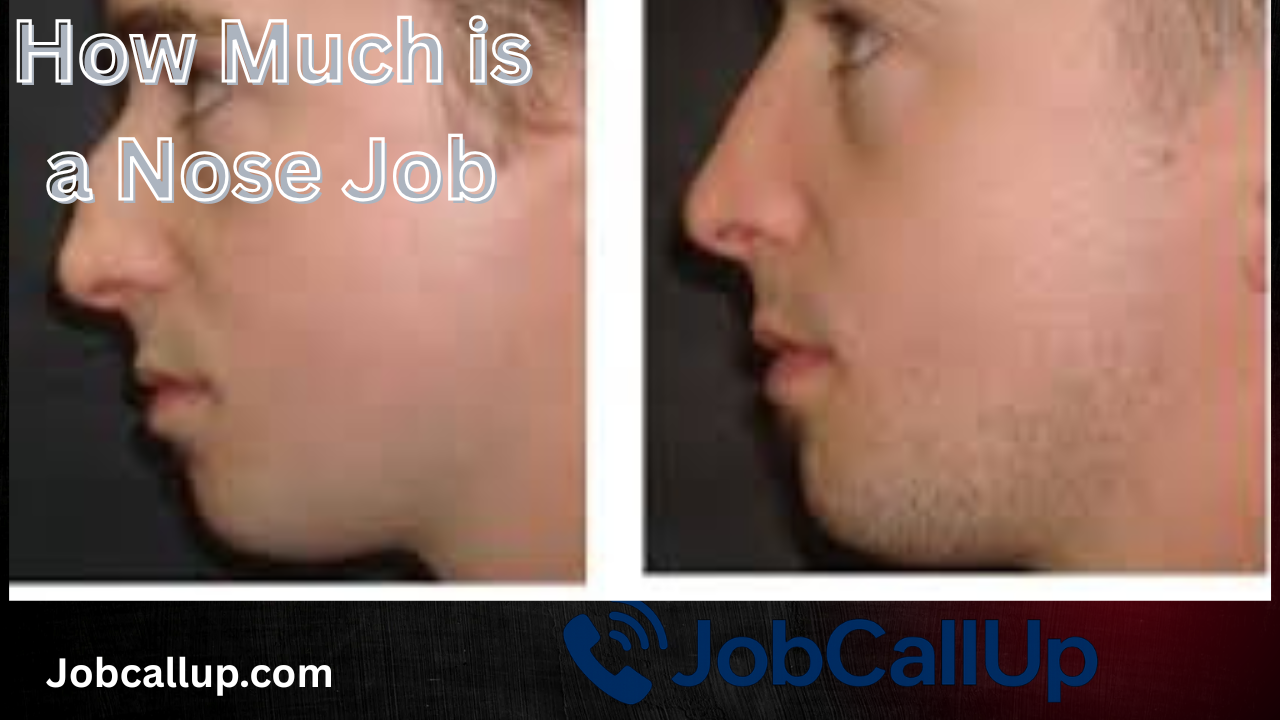 How Much Is A Nose Job